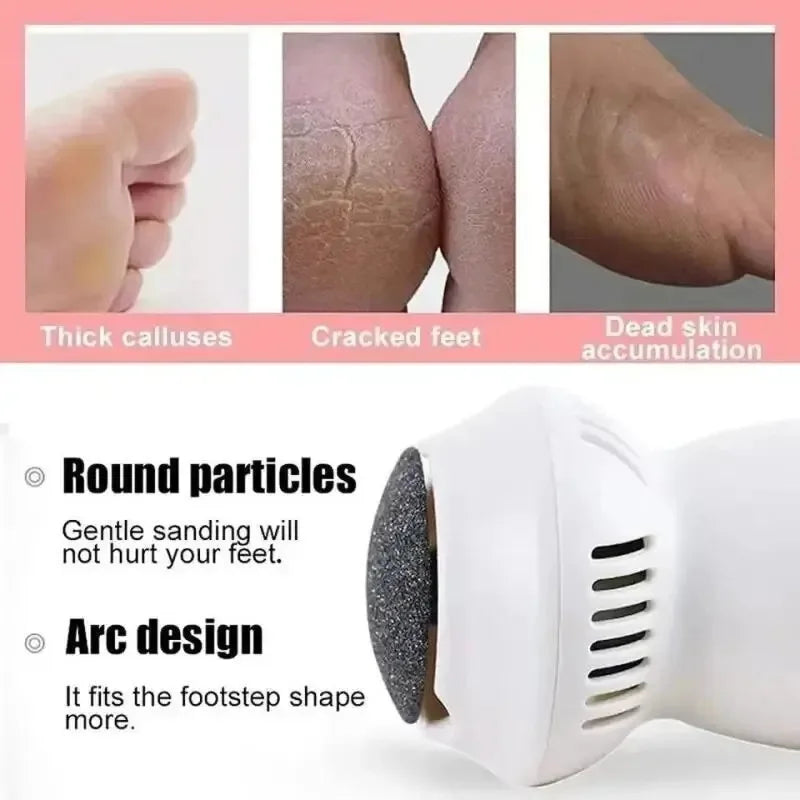 SmoothFeet Pro Callus Remover