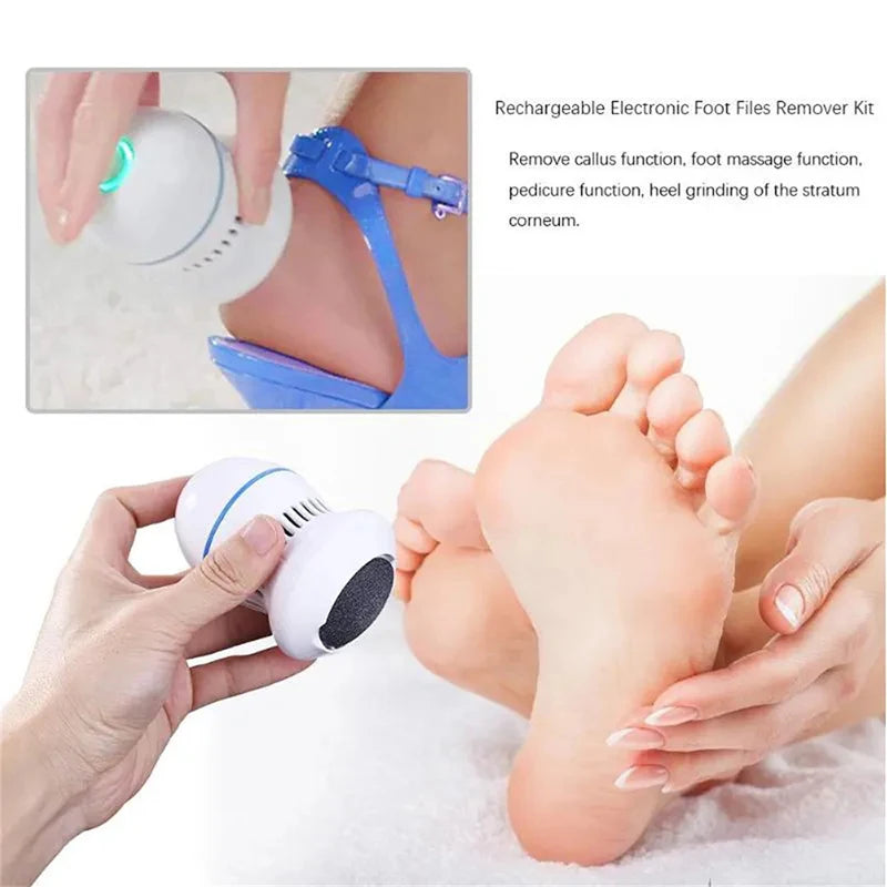 SmoothFeet Pro Callus Remover