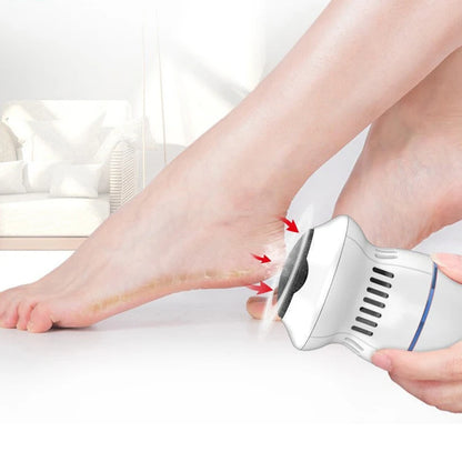 SmoothFeet Pro Callus Remover